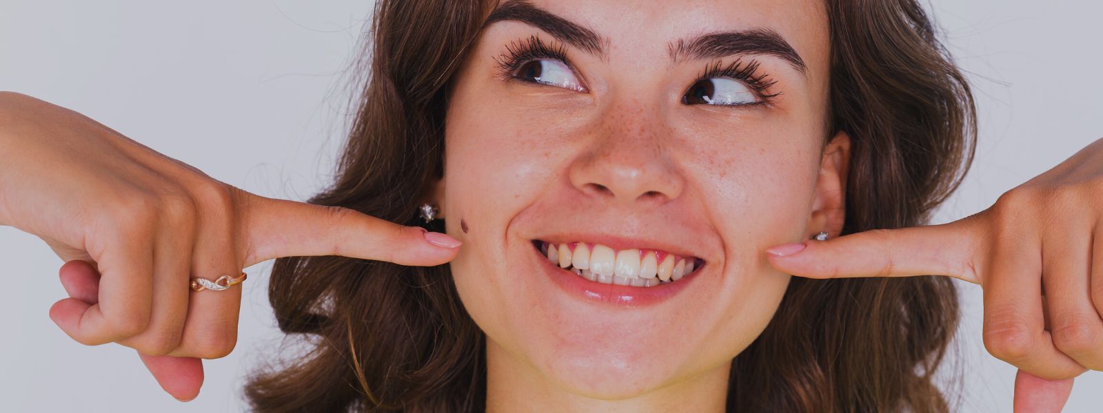 ¿Que son las carillas dentales? El procedimiento dental estético más famoso